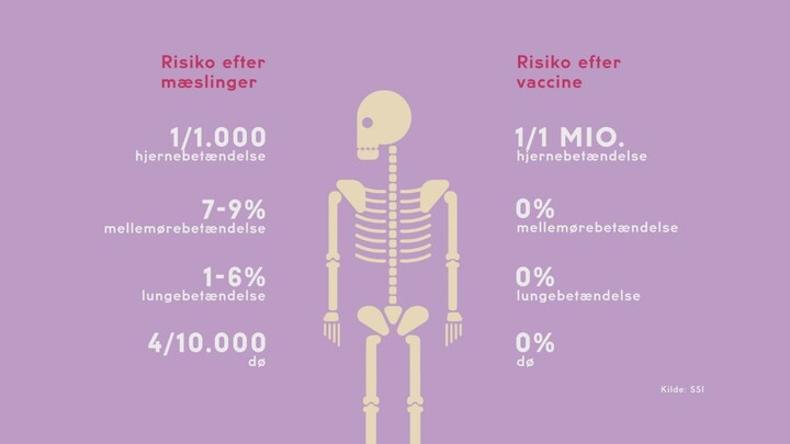 Sundhedsmagasinet præciserer tal om mæslingedød