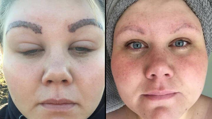 indgreb med permanent make-up ødelægge dit ansigt | Kontant | DR