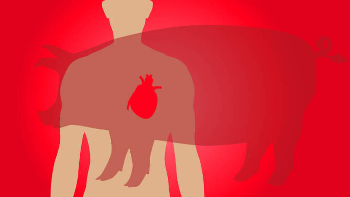 Forskere er for første gang lykkedes med at transplantere et svinehjerte til et menneske