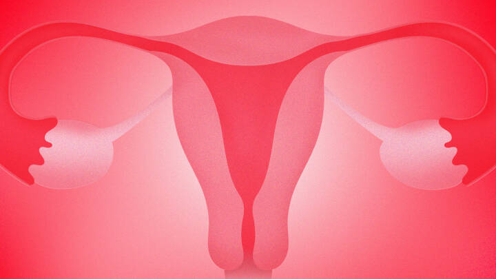 Ny behandling af kræft i livmoderen kan hæve overlevelsen markant